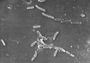 BACTERIA PSEUDOMOMA AERUGINOSA