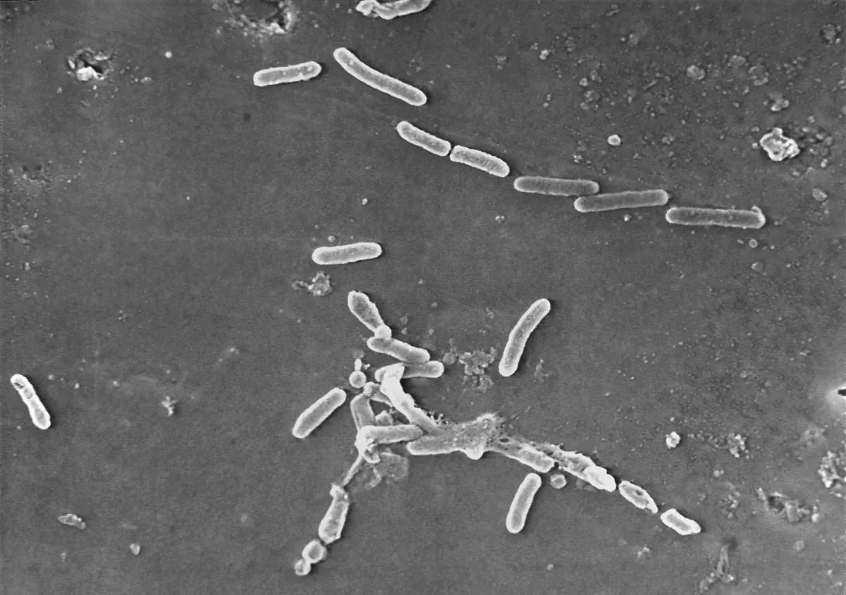 BACTERIA PSEUDOMOMA AERUGINOSA
