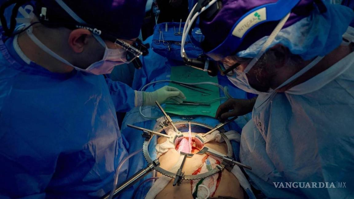 transplante