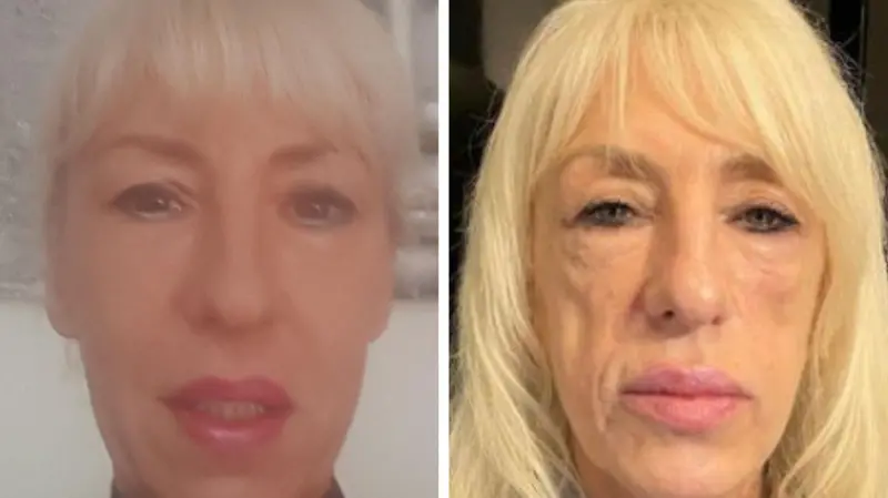 ANTES Y AHORA